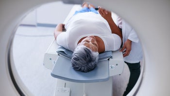 Medicare: MRI: senior woman pre MRI scan 512702234
