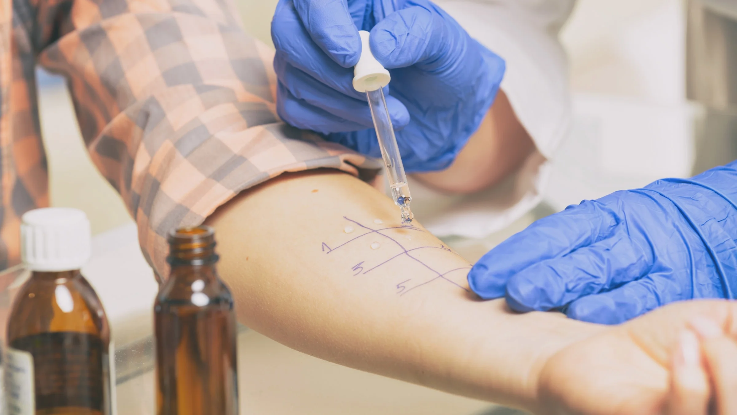 Doctor administers an allergy test in patches on a patient's arm.