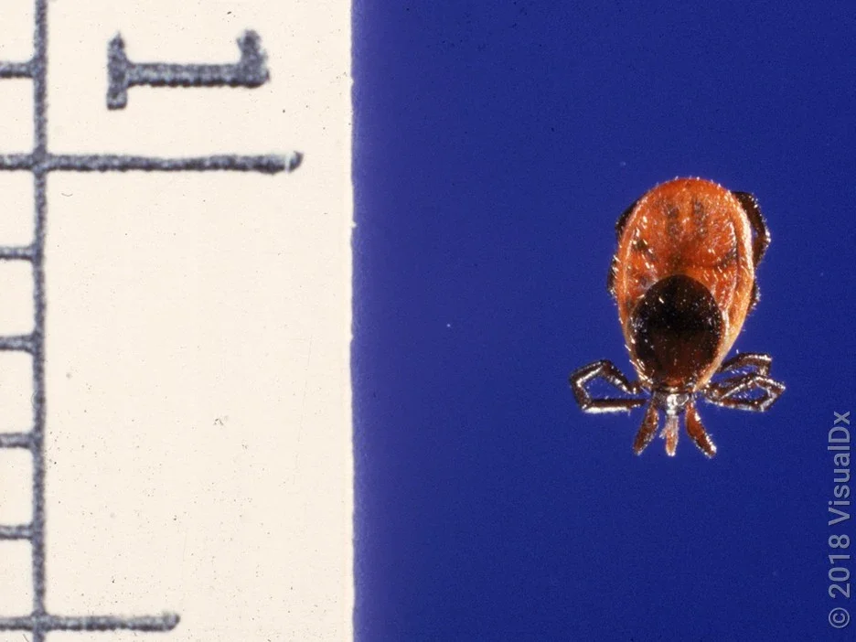 Ticks are very small. This ruler is in millimeters, showing a tick that is 3 mm in length.