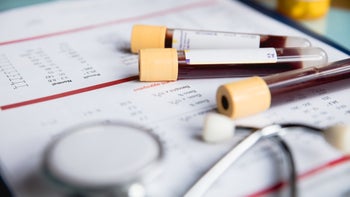 Prostate cancer: PSA: blood test tube results paper-1183370025