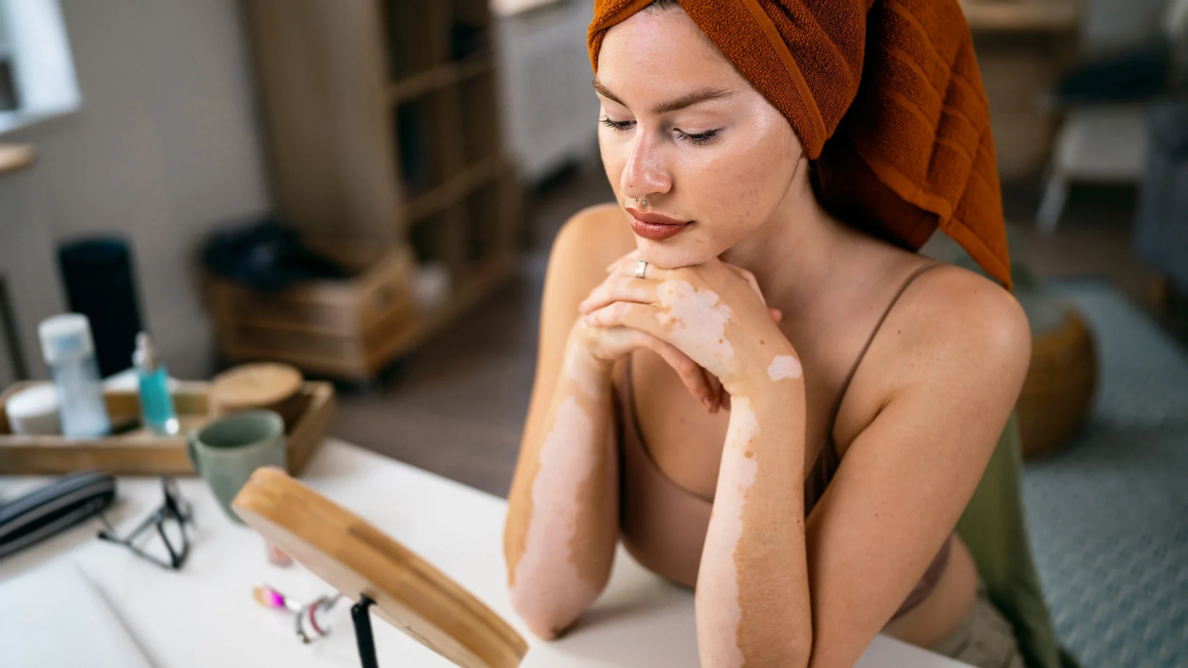 A woman with vitiligo looks in the mirror.
Nadija Pavlovic /iStock via Getty Images Plus