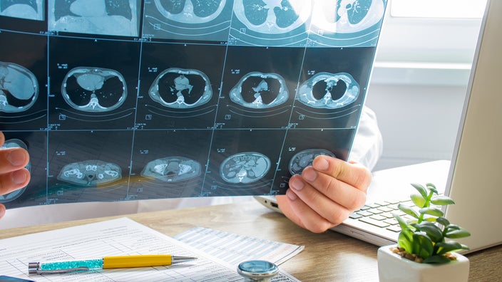 Close-up of a doctor reviewing a lung scan.