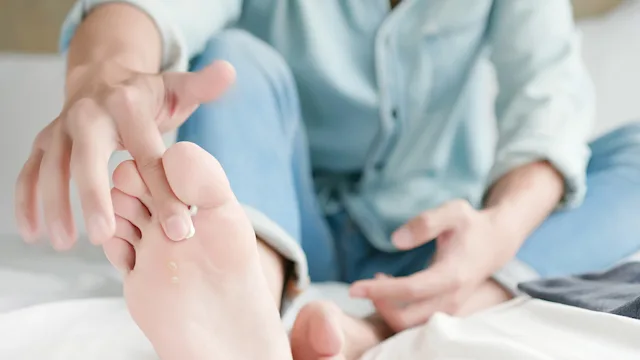 What Are the Best Treatments for Toenail Fungus (Onychomycosis)?