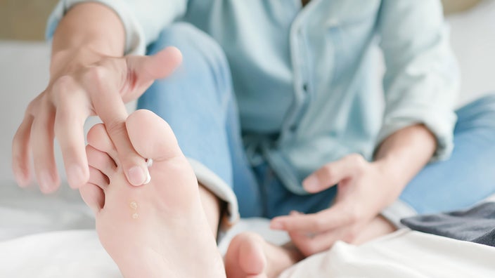 A person applying medication between their toes.