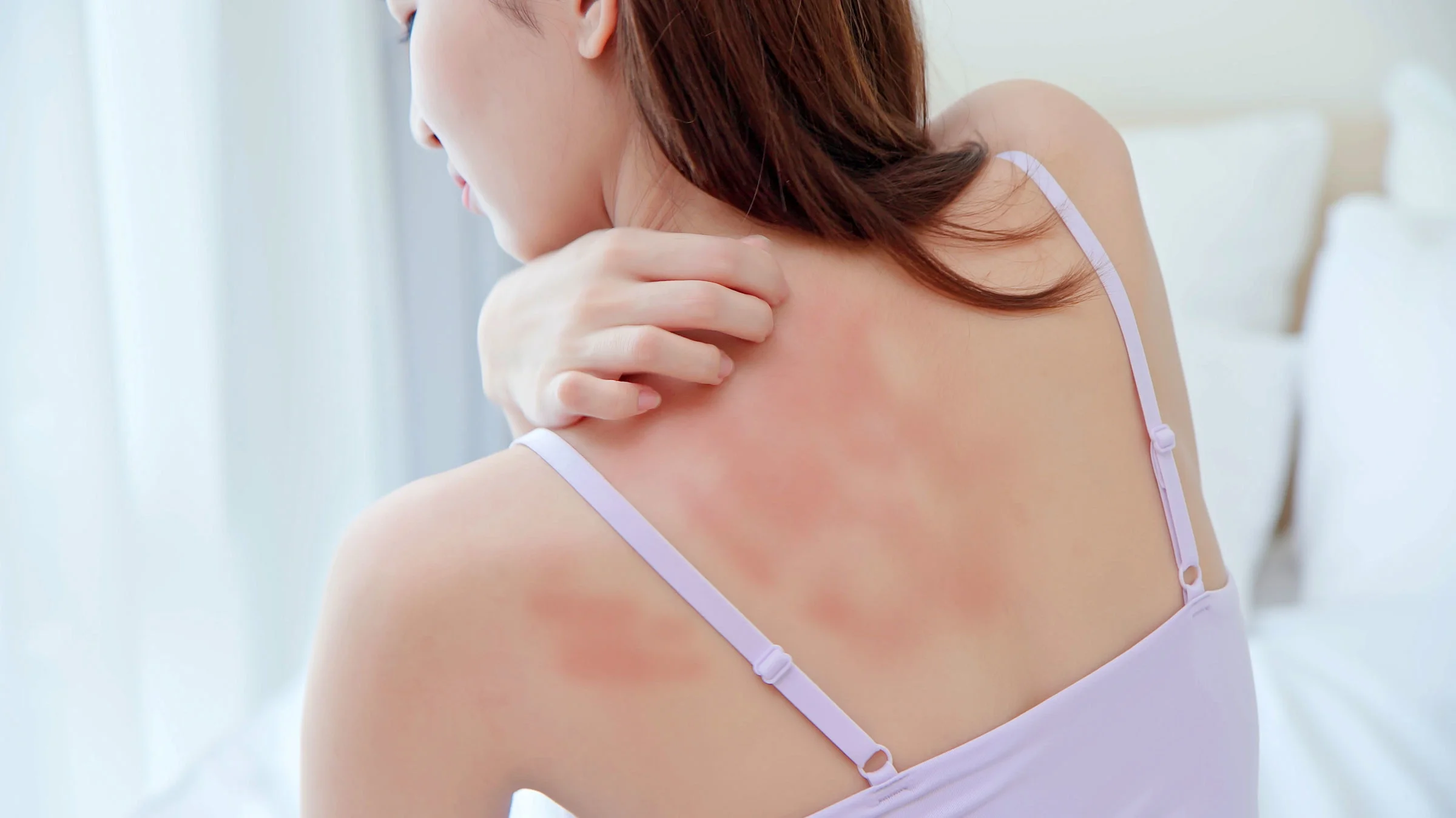 A person with dry skin is scratching their back.
