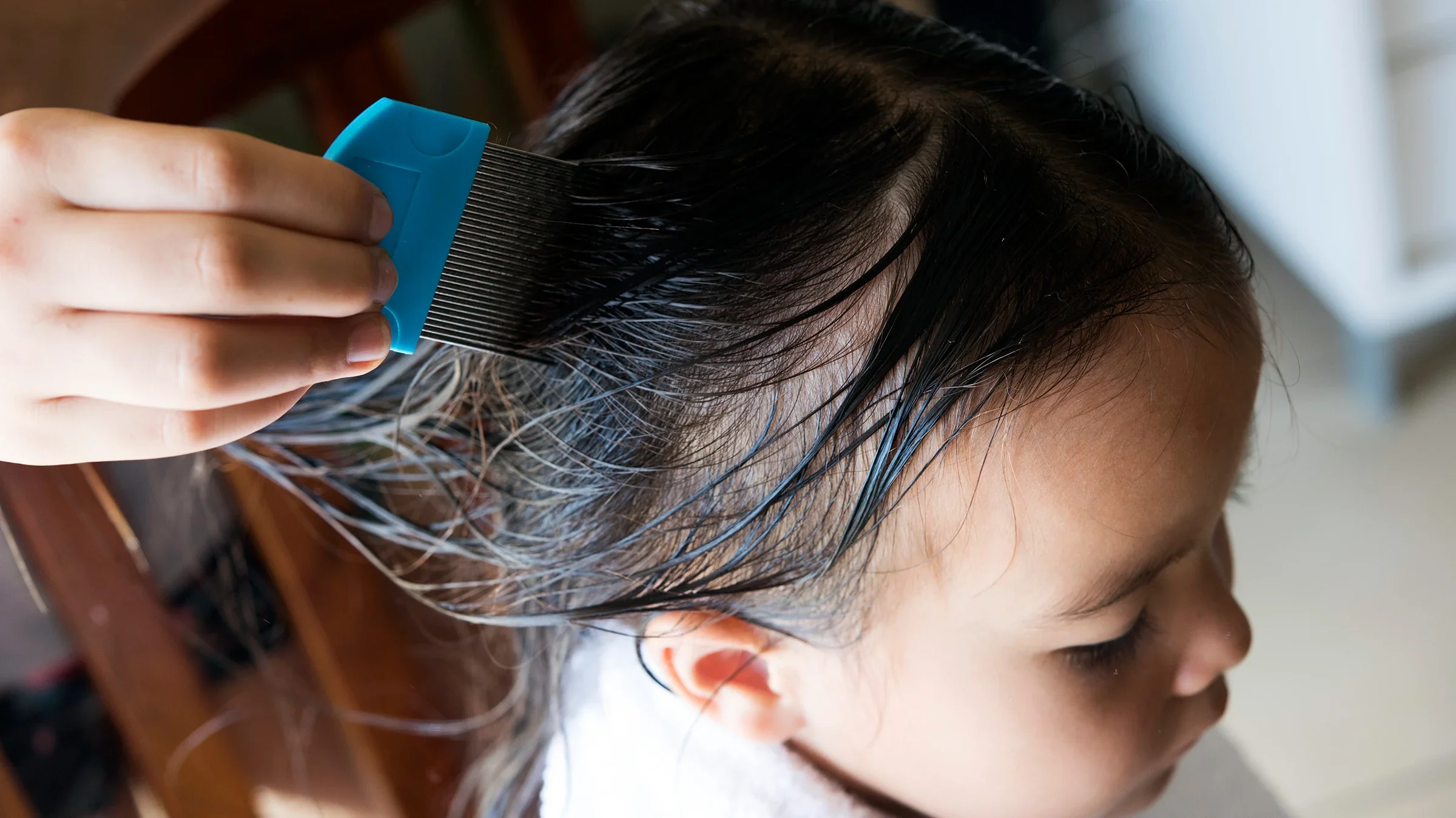 Close-up of a hand doing head lice treatment on child with nit comb
YSach/iStock via Getty Images Plus
