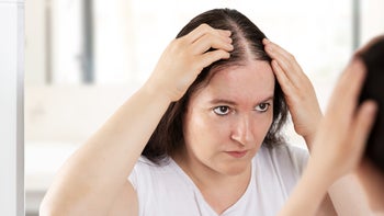 Health: Hair loss:  woman mirror hair loss 1407675558