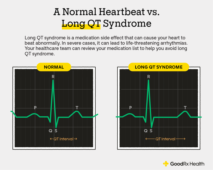 Infographic comparing two EKG visuals: one with a normal heartbeat, and another one with a long QT syndrome.
