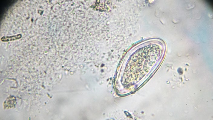 Microscopic image of a pinworm egg.