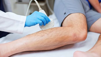 Deep-vein-thrombosis: closeup calf ultrasound 2191672426