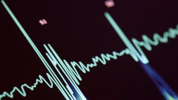 Atrial fibrillation: heart rate monitor screen-184859495