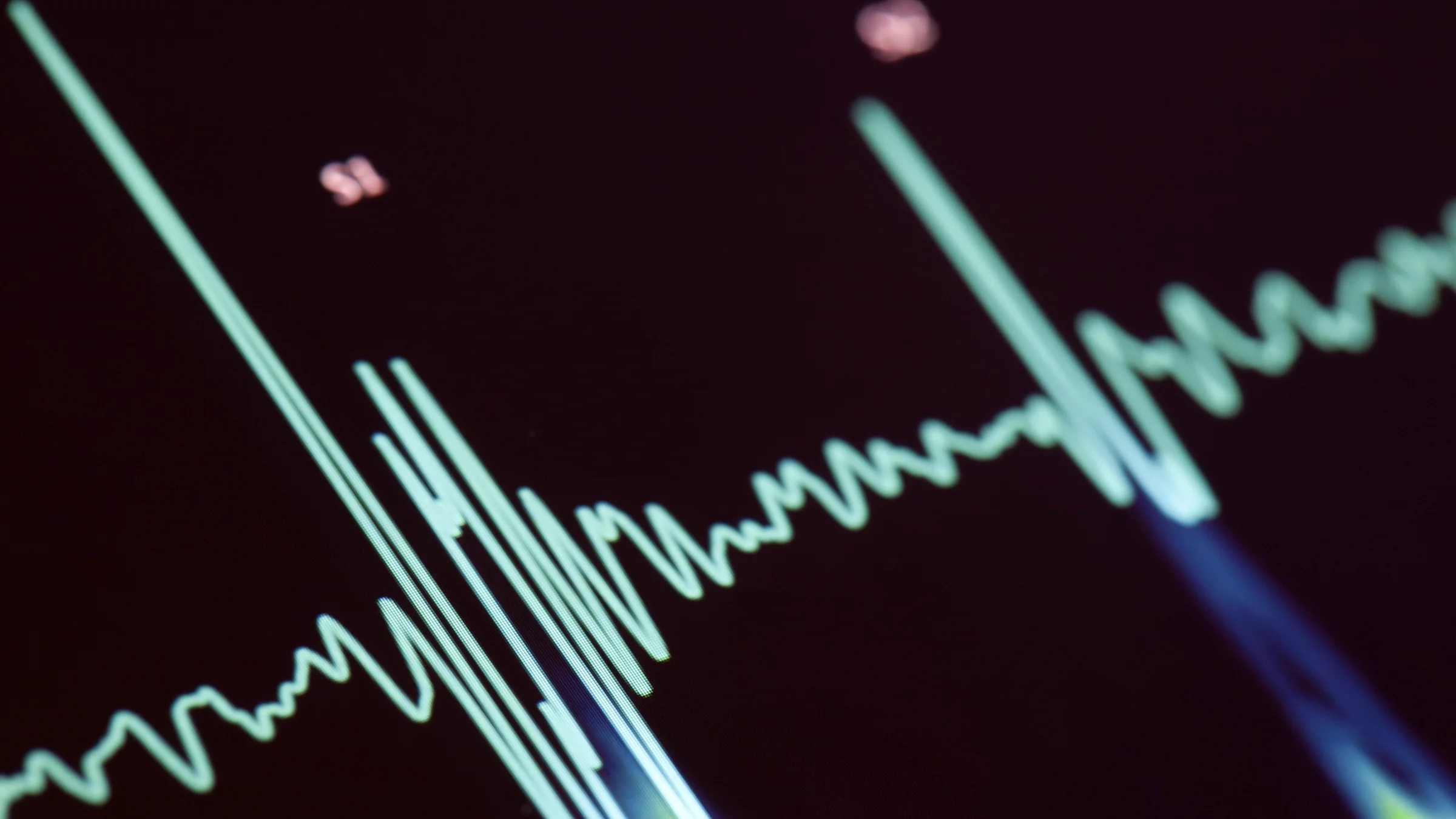 Digital blue line of a heart-rate monitor tracking a heart beat.