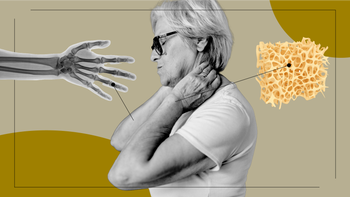 Patient experiences: patient stories feel osteoporosis option 2