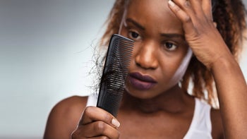 hair-loss: woman with hair loss 1323383005