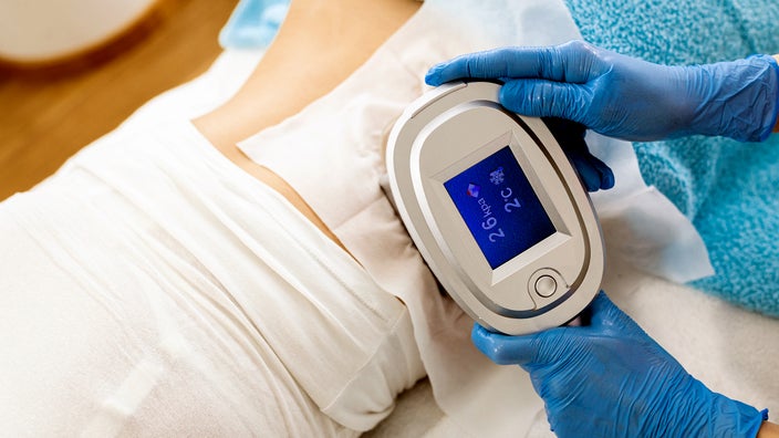 Close-up of a cryolipolysis device on a person's abdomen.