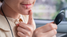 A woman applies a cream to a cold sore with her finger.
Boyloso/iStock via Getty Images Plus