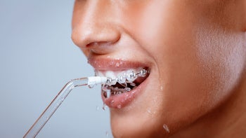 Health: Dental care: closeup cleaning braces with irrigator 849403312