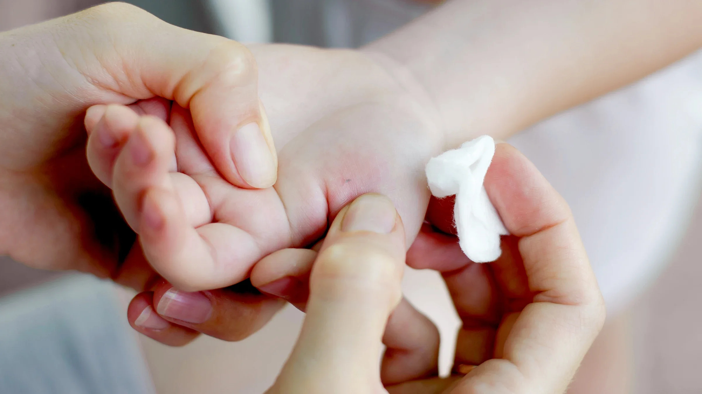 Close-up on the hands of a parent using a cotton pad to help remove a splinter from their child's hand.
Oleksandr Shatyrov/iStock via Getty Images
