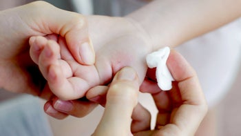 Health: Injuries: removing splinter childs hand-1328856255