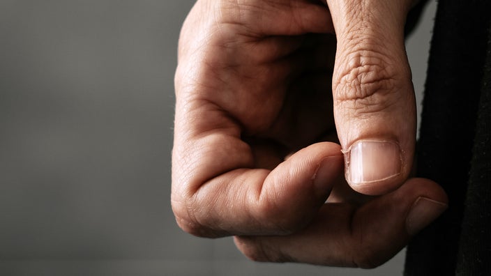 Close-up of hangnail on person's hand