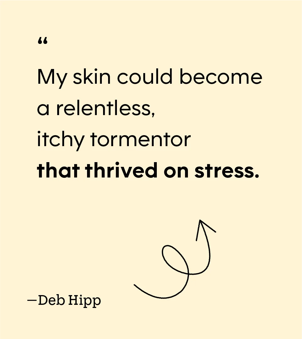 “My skin could become a relentless, itchy tormentor that thrived on stress.” — Deb Hipp
