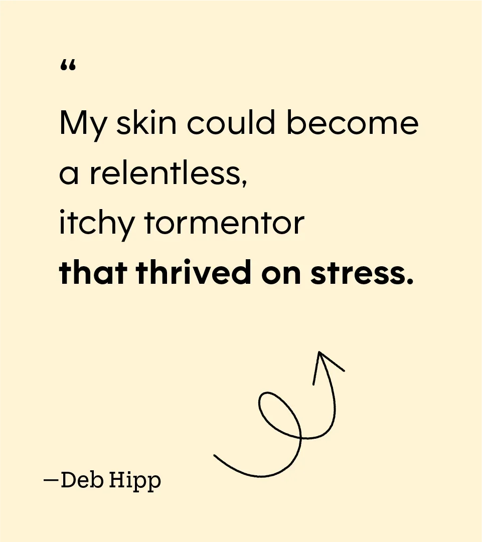 “My skin could become a relentless, itchy tormentor that thrived on stress.” — Deb Hipp