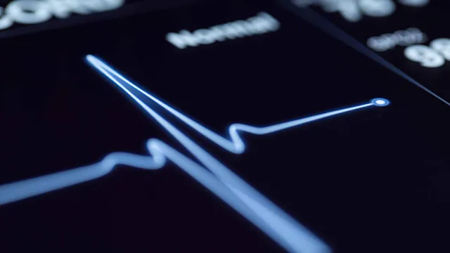 Health: Heart: closeup machine heartbeat 173194744