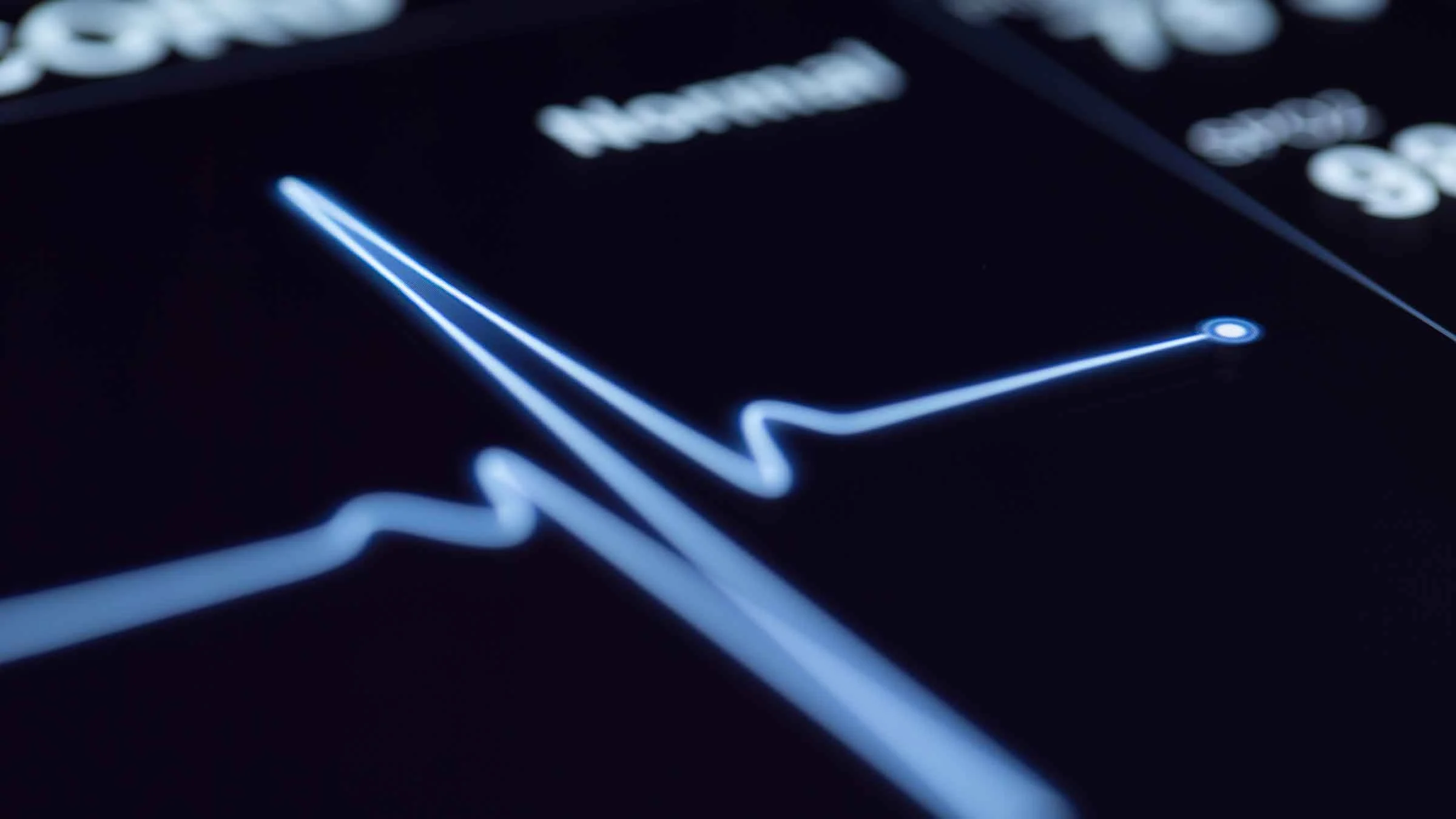 A close-up image shows a heartbeat on a machine