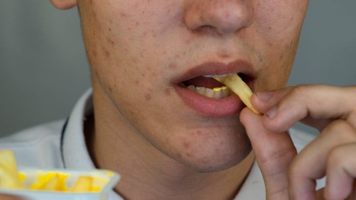 Foods to Support Acne-Prone Skin: A Nutritional Approach