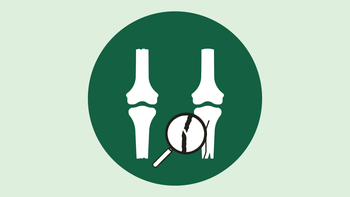 Musculoskeletal: quiz stress fracture-01