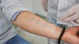 Penicillin allergies are common and often go away on their own. Learn how healthcare providers test for penicillin allergies and what alternative antibiotics you can take.