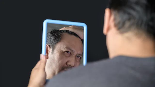 Weight loss: man looking at hairline in mirror 1390412902