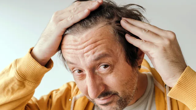 Does Minoxidil (Rogaine) Cause Sexual Side Effects?