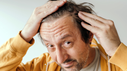 A man is checking his hairline while looking in the mirror.
BitsAndSplits/iStock via Getty Images Plus