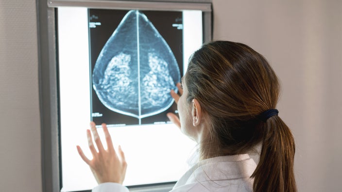 A doctor examining a breast mammogram.
