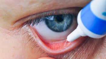 Artificial tears: closeup eye ointment 1132281592