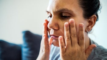 dermatology: woman touching her cheeks 2170972047(1)