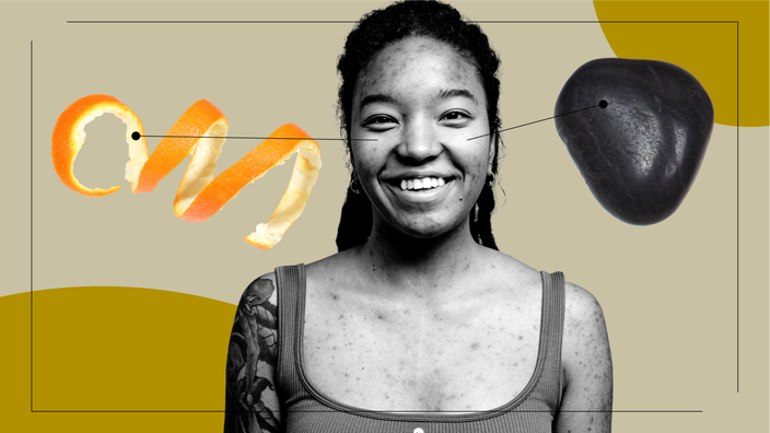 A graphic includes a black-and-white portrait of a woman and items representing what it feels like to take Retin-A: an orange rind and a polished rock.