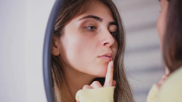 A Guide to Cold Sore Medicines (Prescription and OTC)