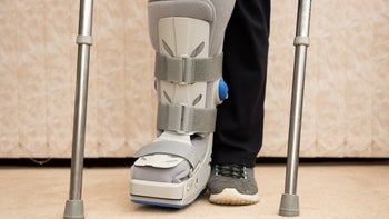 musculoskeletal: closeup soft foot cast and crutches 667565138