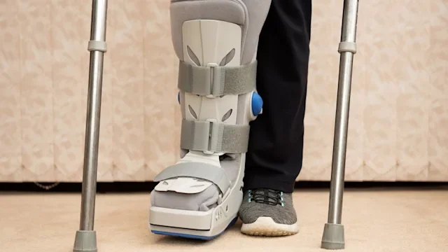 musculoskeletal: closeup soft foot cast and crutches 667565138