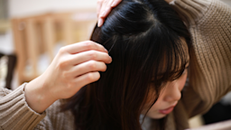 Top down view of a young woman looking at hair and scalp.
yamasan/iStock via Getty Images