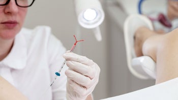 Birth-control: closeup gyno with IUD 1197136924