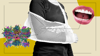 patient stories feel broken bone option 2