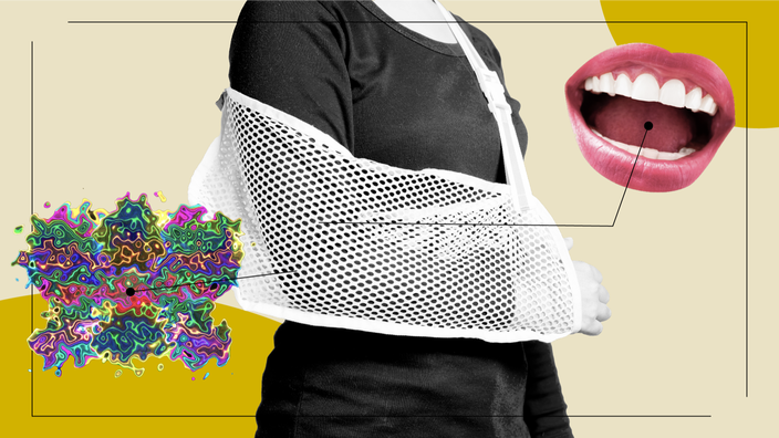 Series graphic illustrating the way a broken bone feels. There is a black and white figure in the middle with an arm sling with diagram lines pointing to different objects. One object is a screaming open mouth cutout and the other is an amorphous throbbing colorful blob.
