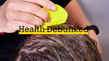 Health: Lice: checking wet hair for lice 504885866