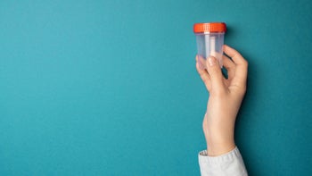 Health: Fentanyl: hand holding urine test cup blue background-1199015077