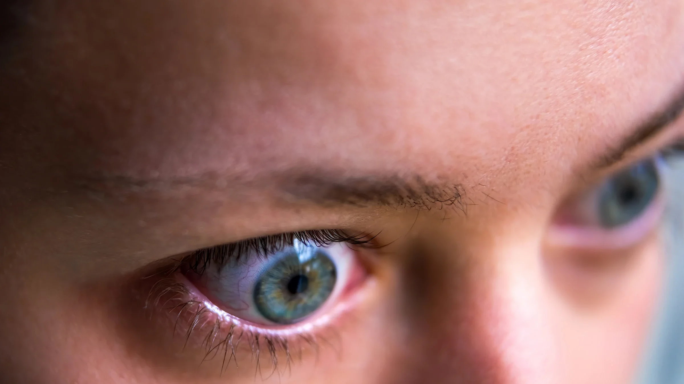 Close-up profile of woman with Graves' disease.
ablokhin/iStock via Getty Images Plus 
