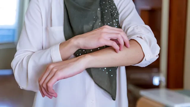 What’s Next When Creams for Psoriasis Aren’t Working?