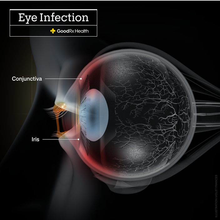 How Does COVID-19 Affect Your Eyes? Pain, Infections, and More - GoodRx